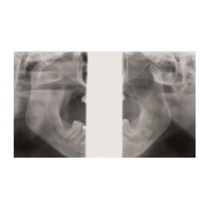 KaVo Pan eXam Plus Ceph - универсальный датчик Pan/Ceph для панорамной томографии, цефалостат, возможность дооснащения функцией 3D-томографии 6x8 см Фото товара KaVo Pan eXam Plus Ceph - универсальный датчик Pan/Ceph для панорамной томографии, цефалостат, возможность дооснащения функцией 3D-томографии 6x8 см