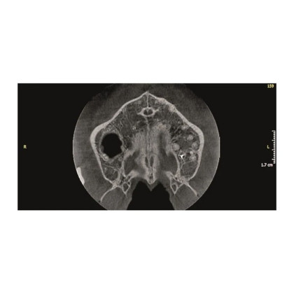 KaVo Pan eXam Plus Ceph - универсальный датчик Pan/Ceph для панорамной томографии, цефалостат, возможность дооснащения функцией 3D-томографии 6x8 см Фото товара KaVo Pan eXam Plus Ceph - универсальный датчик Pan/Ceph для панорамной томографии, цефалостат, возможность дооснащения функцией 3D-томографии 6x8 см