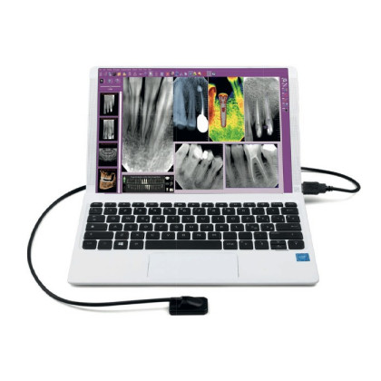 MyRay Zen-X HD - цифровой радиовизиограф нового поколения, HD CMOS, с позиционерами Фото товара MyRay Zen-X HD - цифровой радиовизиограф нового поколения, HD CMOS, с позиционерами