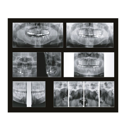 Papaya 3D Plus 16x8 - компьютерный томограф с цефалостатом Фото товара Papaya 3D Plus 16x8 - компьютерный томограф с цефалостатом