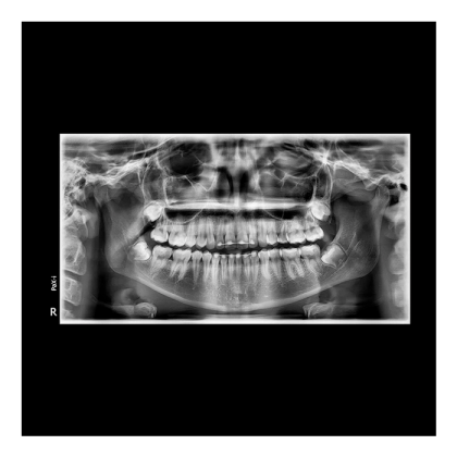 Pax-i 3D - панорамный аппарат и конусно-лучевой томограф, FOV 10x8.5 см Фото товара Pax-i 3D - панорамный аппарат и конусно-лучевой томограф, FOV 10x8.5 см