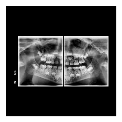 Pax-i 3D - панорамный аппарат и конусно-лучевой томограф, FOV 10x8.5 см Фото товара Pax-i 3D - панорамный аппарат и конусно-лучевой томограф, FOV 10x8.5 см