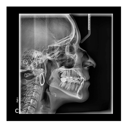 Pax-i 3D - панорамный аппарат и конусно-лучевой томограф, FOV 10x8.5 см Фото товара Pax-i 3D - панорамный аппарат и конусно-лучевой томограф, FOV 10x8.5 см