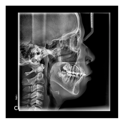 Pax-i 3D - панорамный аппарат и конусно-лучевой томограф, FOV 10x8.5 см Фото товара Pax-i 3D - панорамный аппарат и конусно-лучевой томограф, FOV 10x8.5 см