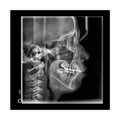 Pax-i 3D - панорамный аппарат и конусно-лучевой томограф, FOV 17x15 см | Vatech Фото товара Pax-i 3D - панорамный аппарат и конусно-лучевой томограф, FOV 17x15 см | Vatech