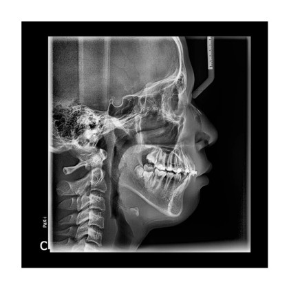 Pax-i 3D - панорамный аппарат и конусно-лучевой томограф, FOV 17x15 см | Vatech Фото товара Pax-i 3D - панорамный аппарат и конусно-лучевой томограф, FOV 17x15 см | Vatech