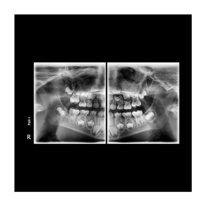 Pax-i 3D - панорамный аппарат и конусно-лучевой томограф, FOV 17x15 см | Vatech Фото товара Pax-i 3D - панорамный аппарат и конусно-лучевой томограф, FOV 17x15 см | Vatech