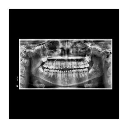 Pax-i 3D - панорамный аппарат и конусно-лучевой томограф, FOV 17x15 см | Vatech Фото товара Pax-i 3D - панорамный аппарат и конусно-лучевой томограф, FOV 17x15 см | Vatech
