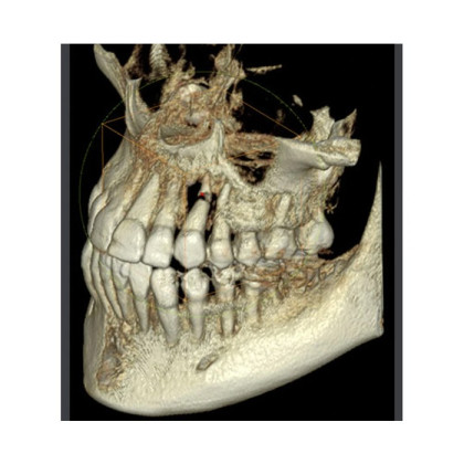 RAYSCAN Symphony Alpha 3D - ортопантомограф с компьютерным томографом, 3D 9х9 см Фото товара RAYSCAN Symphony Alpha 3D - ортопантомограф с компьютерным томографом, 3D 9х9 см