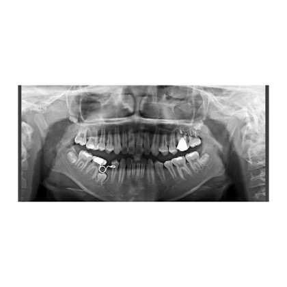 Фото товара RAYSCAN Symphony Alpha M3DL – томограф 3 в 1: ортопантомограф и цефалостат (OneShot) 33х33 см, компьютерный томограф 3D 9х9 см