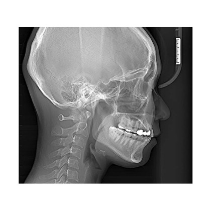 Фото товара RAYSCAN Symphony Alpha Plus 120 (3D) - ортопантомограф с компьютерным томографом, 3D (4х12)*(3х10) см