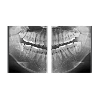 Фото товара RAYSCAN Symphony Alpha Plus 120 M3DL - ортопантомограф с цефалостатом (OneShot) 33х33 см и компьютерным томографом 3D (4х12)*(3х10) см