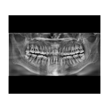 Vatech A9 RC - панорамный рентгеновский цифровой аппарат с функцией КТ, c цефалостатом, 10х8 Фото товара Vatech A9 RC - панорамный рентгеновский цифровой аппарат с функцией КТ, c цефалостатом, 10х8