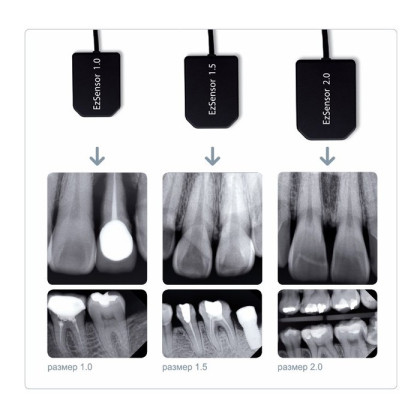 Фото товара Vatech EzSensor - цифровой радиовизиограф