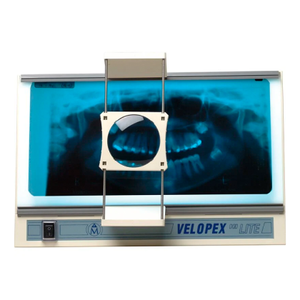 Velopex Hi Lite Viewer - стоматологический негатоскоп для интраоральных и панорамных рентгенограмм, с лупой Фото товара Velopex Hi Lite Viewer - стоматологический негатоскоп для интраоральных и панорамных рентгенограмм, с лупой