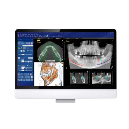 X-Radius Trio Plus Comfort 3D - стоматологический томограф с цефалостатом, FOV 13х16/16x18 Фото товара X-Radius Trio Plus Comfort 3D - стоматологический томограф с цефалостатом, FOV 13х16/16x18