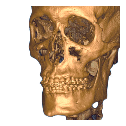Фото товара i-CAT 3D eXam / i-CAT - аппарат панорамный рентгеновский стоматологический с функцией томографии