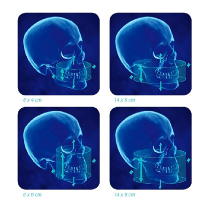 Фото товара i-CAT 3D eXam / i-CAT - аппарат панорамный рентгеновский стоматологический с функцией томографии