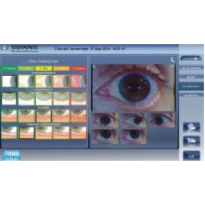 Авторефрактометр VX120+ DRY EYE Фото товара Авторефрактометр VX120+ DRY EYE