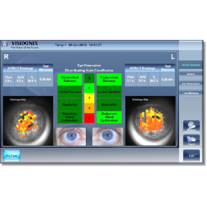 Авторефрактометр VX120+ DRY EYE Фото товара Авторефрактометр VX120+ DRY EYE