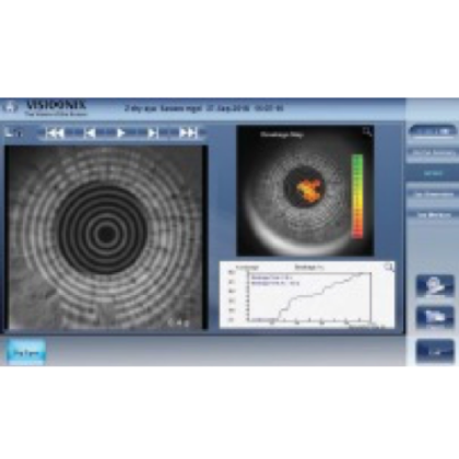 Авторефрактометр VX120+ DRY EYE Фото товара Авторефрактометр VX120+ DRY EYE