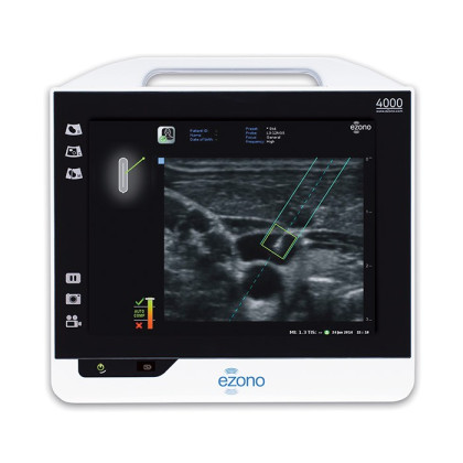 Фото товара Аппарат УЗИ eZono 4000