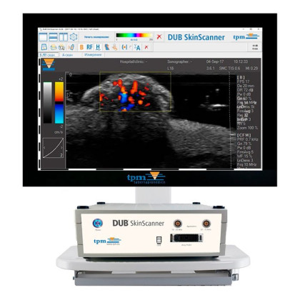 Фото товара Аппарат для ультразвукового исследования кожи DUB SKINSCANNER (аппарат для определения морфофункциональных параметров кожи)