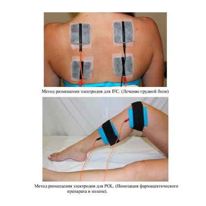 Фото товара Аппарат для электротерапии и электростимуляции Ibramed Neurodyn (6 каналов)