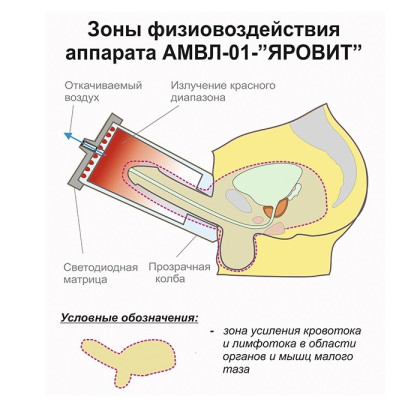 Аппарат – массажёр вакуумный фототерапевтический АМВЛ-01 Яровит с автономным управлением Яровит - Ярь Фото товара Аппарат – массажёр вакуумный фототерапевтический АМВЛ-01 Яровит с автономным управлением Яровит - Ярь