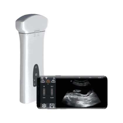 Фото товара Беспроводная ультразвуковая система Delta 8 портативная