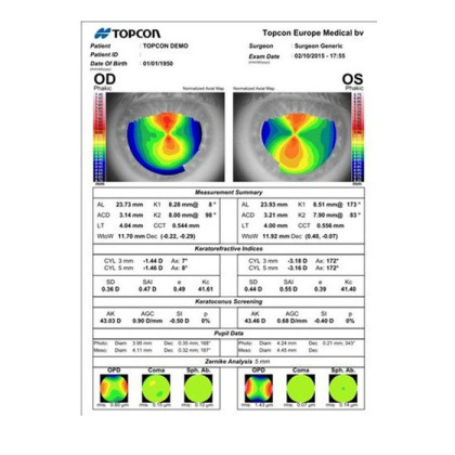 Фото товара Биометр ALADDIN, VISIA Imaging