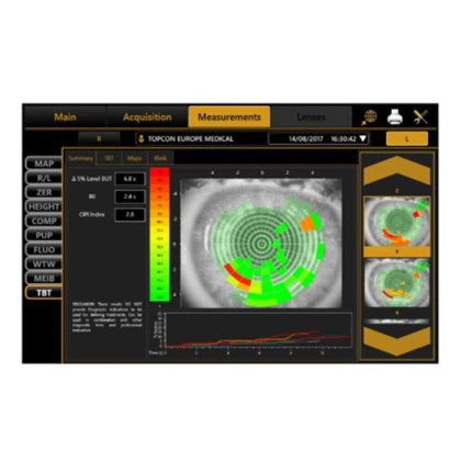 Фото товара Биометр ALADDIN, VISIA Imaging