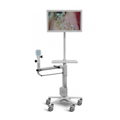 Фото товара Видеокольпоскоп Цифровой SLV-101