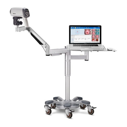 Фото товара Видеокольпоскопы С3A/С6A, Edan