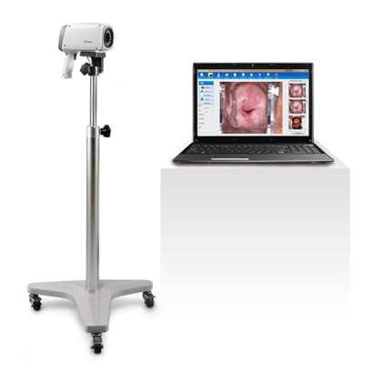 Фото товара Видеокольпоскопы С3A/С6A, Edan