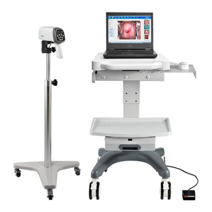 Фото товара Видеокольпоскопы С3A/С6A, Edan