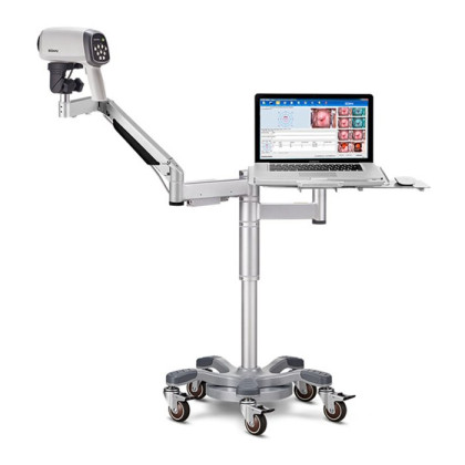 Видеокольпоскопы С6 HD/С6A HD, Edan Фото товара Видеокольпоскопы С6 HD/С6A HD, Edan