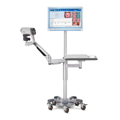 Видеокольпоскопы С6 HD/С6A HD, Edan Фото товара Видеокольпоскопы С6 HD/С6A HD, Edan