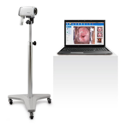 Видеокольпоскопы С6 HD/С6A HD, Edan Фото товара Видеокольпоскопы С6 HD/С6A HD, Edan