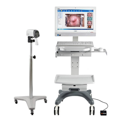 Видеокольпоскопы С6 HD/С6A HD, Edan Фото товара Видеокольпоскопы С6 HD/С6A HD, Edan