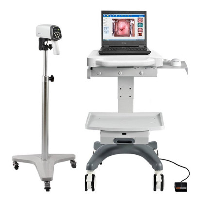 Видеокольпоскопы С6 HD/С6A HD, Edan Фото товара Видеокольпоскопы С6 HD/С6A HD, Edan