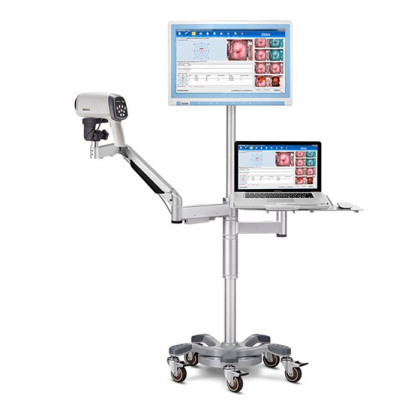 Видеокольпоскопы С6 HD/С6A HD, Edan Фото товара Видеокольпоскопы С6 HD/С6A HD, Edan