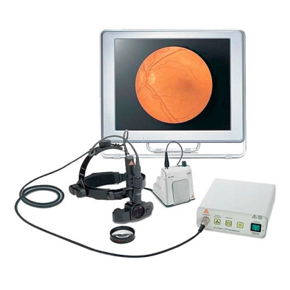 Видеоофтальмоскоп Video OMEGA 2C, Heine Фото товара Видеоофтальмоскоп Video OMEGA 2C, Heine