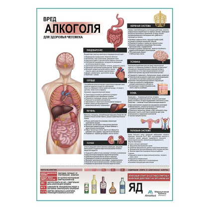 Фото товара Вред алкоголя для здоровья плакат глянцевый А1+/А2+