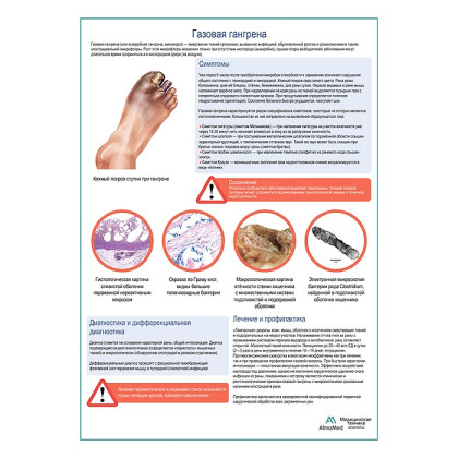 Газовая гангрена медицинский плакат А1+/A2+ Фото товара Газовая гангрена медицинский плакат А1+/A2+