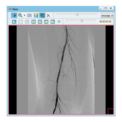 Фото товара Информационная система АПК АрхиМед PACS/RIS