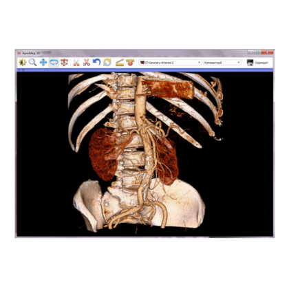 Фото товара Информационная система АПК АрхиМед PACS/RIS