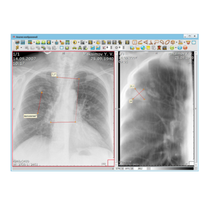 Фото товара Информационная система АПК АрхиМед PACS/RIS