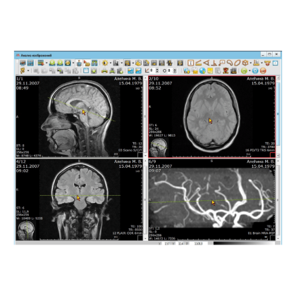 Фото товара Информационная система АПК АрхиМед PACS/RIS