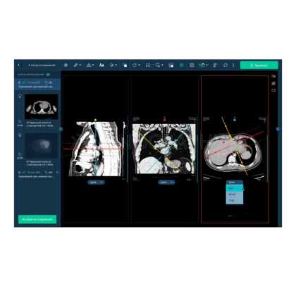 Фото товара Информационная система АПК АрхиМед PACS/RIS